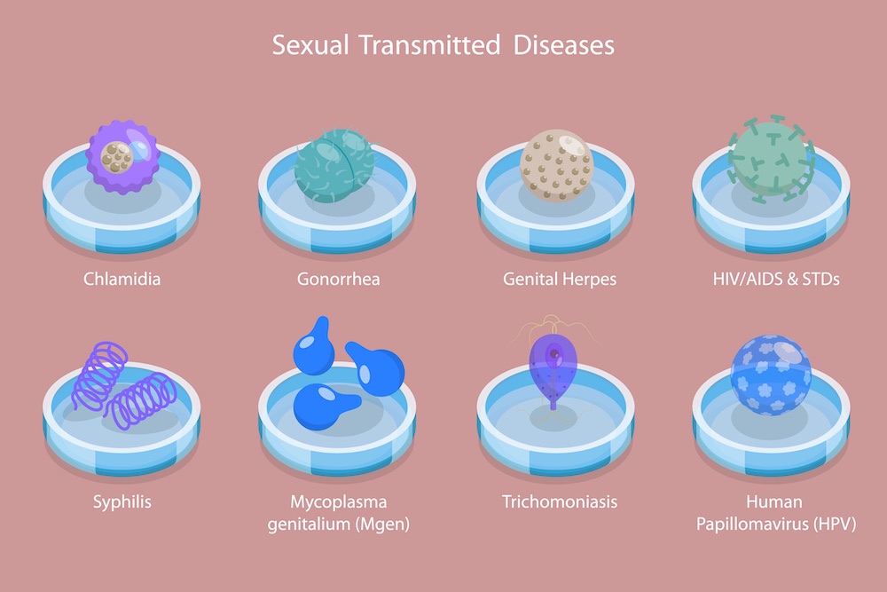Illustration av sexuellt överförbara sjukdomar